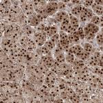 PPOX Antibody in Immunohistochemistry (IHC)