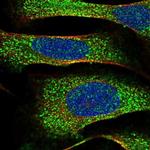 CAP1 Polyclonal Antibody