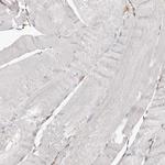 CAP1 Antibody in Immunohistochemistry (Paraffin) (IHC (P))