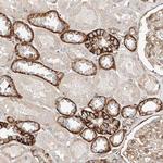 FAM188B Antibody in Immunohistochemistry (Paraffin) (IHC (P))