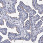 FAM188B Antibody in Immunohistochemistry (Paraffin) (IHC (P))
