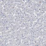 FAM188B Antibody in Immunohistochemistry (Paraffin) (IHC (P))