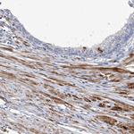 FAM188B Antibody in Immunohistochemistry (Paraffin) (IHC (P))