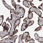 KLDC3 Antibody in Immunohistochemistry (Paraffin) (IHC (P))