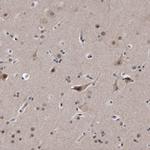 KLDC3 Antibody in Immunohistochemistry (IHC)