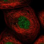 KLDC3 Polyclonal Antibody