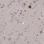 KLDC3 Antibody in Immunohistochemistry (IHC)