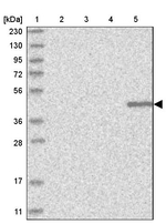 KLDC3 Antibody in Western Blot (WB)