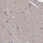 KLDC3 Polyclonal Antibody