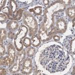 KLDC3 Antibody in Immunohistochemistry (Paraffin) (IHC (P))