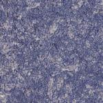 KLDC3 Polyclonal Antibody