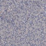 KLDC3 Antibody in Immunohistochemistry (Paraffin) (IHC (P))