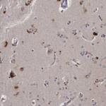 KLDC3 Antibody in Immunohistochemistry (IHC)