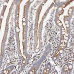 IQGAP3 Antibody in Immunohistochemistry (Paraffin) (IHC (P))