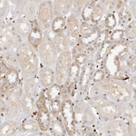 IQGAP3 Antibody in Immunohistochemistry (Paraffin) (IHC (P))