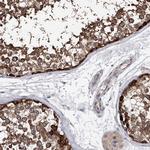 NUDT17 Antibody in Immunohistochemistry (IHC)