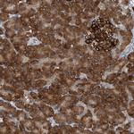 YRDC Antibody in Immunohistochemistry (Paraffin) (IHC (P))
