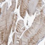 YRDC Antibody in Immunohistochemistry (Paraffin) (IHC (P))