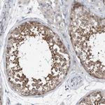 YRDC Antibody in Immunohistochemistry (Paraffin) (IHC (P))