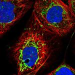 SMPDL3A Polyclonal Antibody