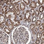 SMPDL3A Antibody in Immunohistochemistry (Paraffin) (IHC (P))