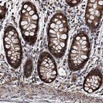 SMPDL3A Antibody in Immunohistochemistry (Paraffin) (IHC (P))