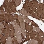 SMPDL3A Antibody in Immunohistochemistry (Paraffin) (IHC (P))