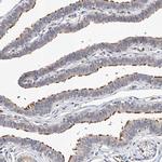 LACE1 Polyclonal Antibody