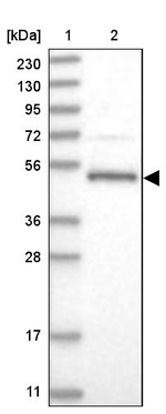 LACE1 Antibody in Western Blot (WB)