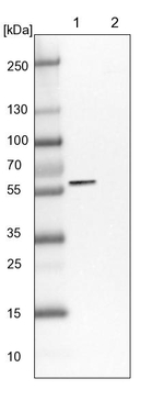 LACE1 Antibody in Western Blot (WB)