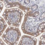 LACE1 Antibody in Immunohistochemistry (Paraffin) (IHC (P))