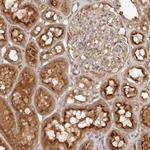 PKIB Polyclonal Antibody