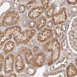 LTV1 Homolog Antibody in Immunohistochemistry (Paraffin) (IHC (P))