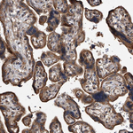 LTV1 Homolog Antibody in Immunohistochemistry (Paraffin) (IHC (P))