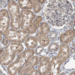LTV1 Homolog Antibody in Immunohistochemistry (Paraffin) (IHC (P))