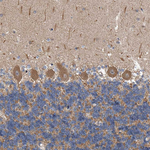 LTV1 Homolog Antibody in Immunohistochemistry (Paraffin) (IHC (P))