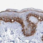 FRS3 Antibody in Immunohistochemistry (IHC)
