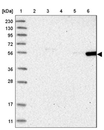 FRS3 Antibody in Western Blot (WB)