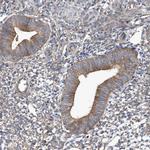 TJAP1 Antibody in Immunohistochemistry (Paraffin) (IHC (P))