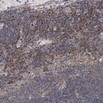 TJAP1 Antibody in Immunohistochemistry (Paraffin) (IHC (P))