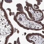 TJAP1 Antibody in Immunohistochemistry (IHC)