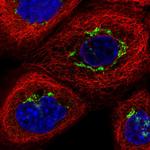 TJAP1 Polyclonal Antibody