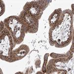 TJAP1 Antibody in Immunohistochemistry (IHC)