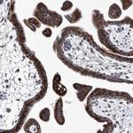 TJAP1 Antibody in Immunohistochemistry (IHC)