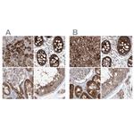KLC4 Antibody in Immunohistochemistry (IHC)