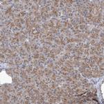 KLC4 Antibody in Immunohistochemistry (IHC)