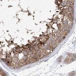 KLC4 Antibody in Immunohistochemistry (IHC)