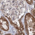 KLC4 Antibody in Immunohistochemistry (IHC)