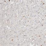 CEP162 Antibody in Immunohistochemistry (IHC)
