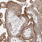 CEP162 Antibody in Immunohistochemistry (IHC)